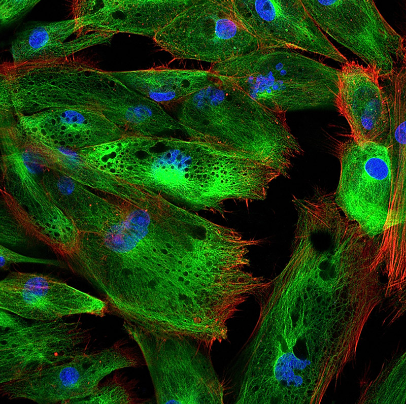 Nucleofector Teknolojisi