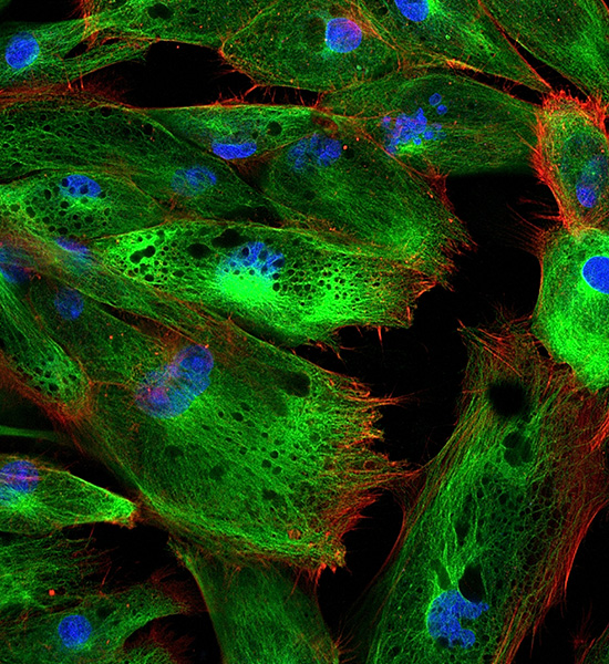 Transfeksiyon – Elektroporasyon: Nucleofector Teknolojisi