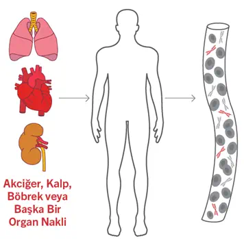 Hücre Dışı DNA Ölçümü ile Nakil Gözetimi