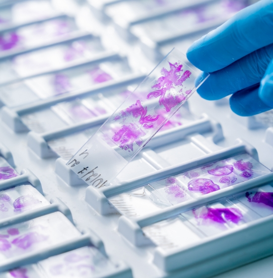 Smear Testleri Otomasyon Sistemleri